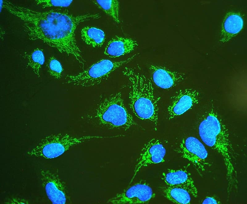 HSPD1 / HSP60 Antibody (aa260-496)