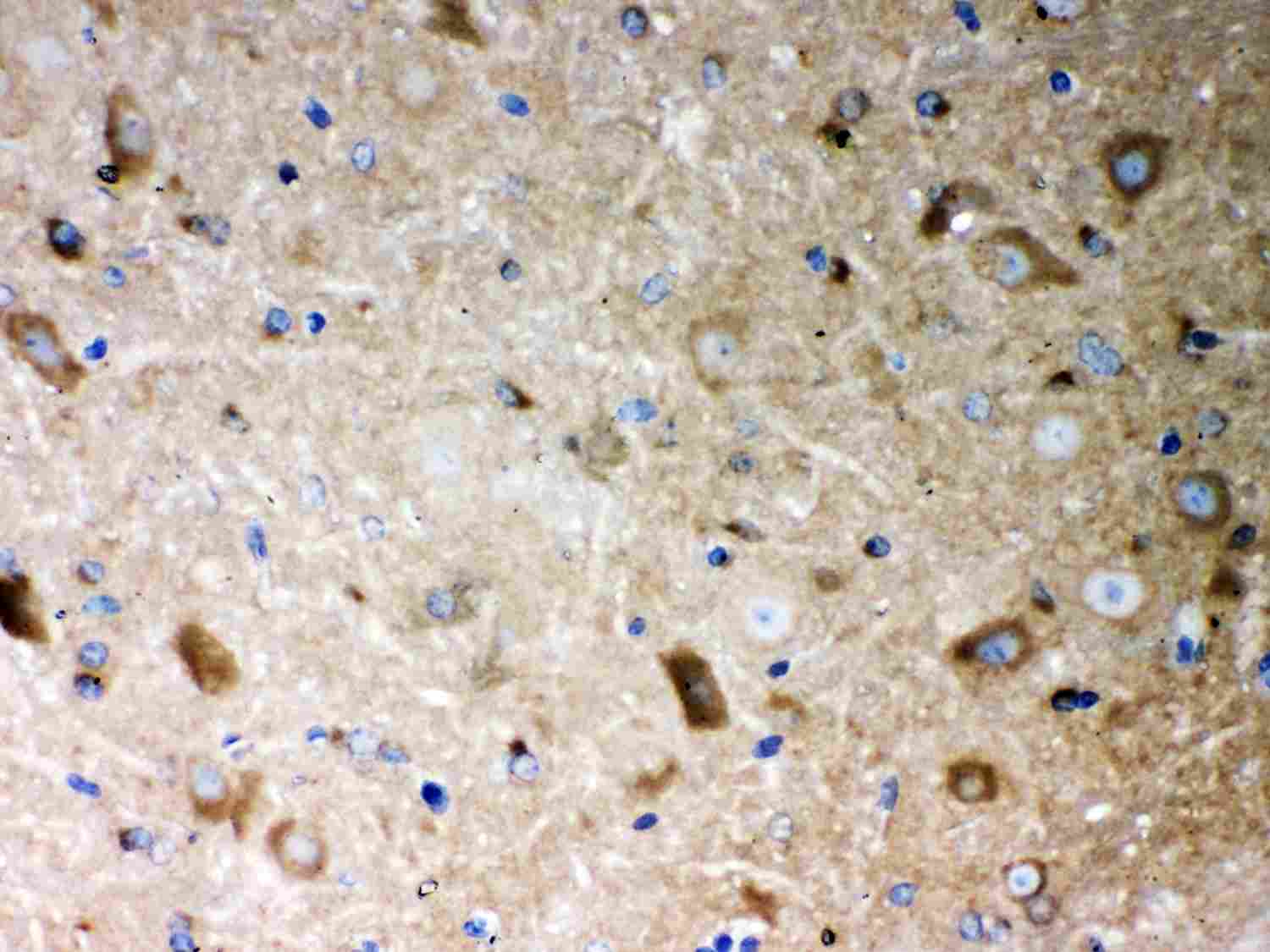 Polyclonal Rabbit anti-Human PP2Ac / PPP2CA Antibody (aa1-309, IHC, WB)