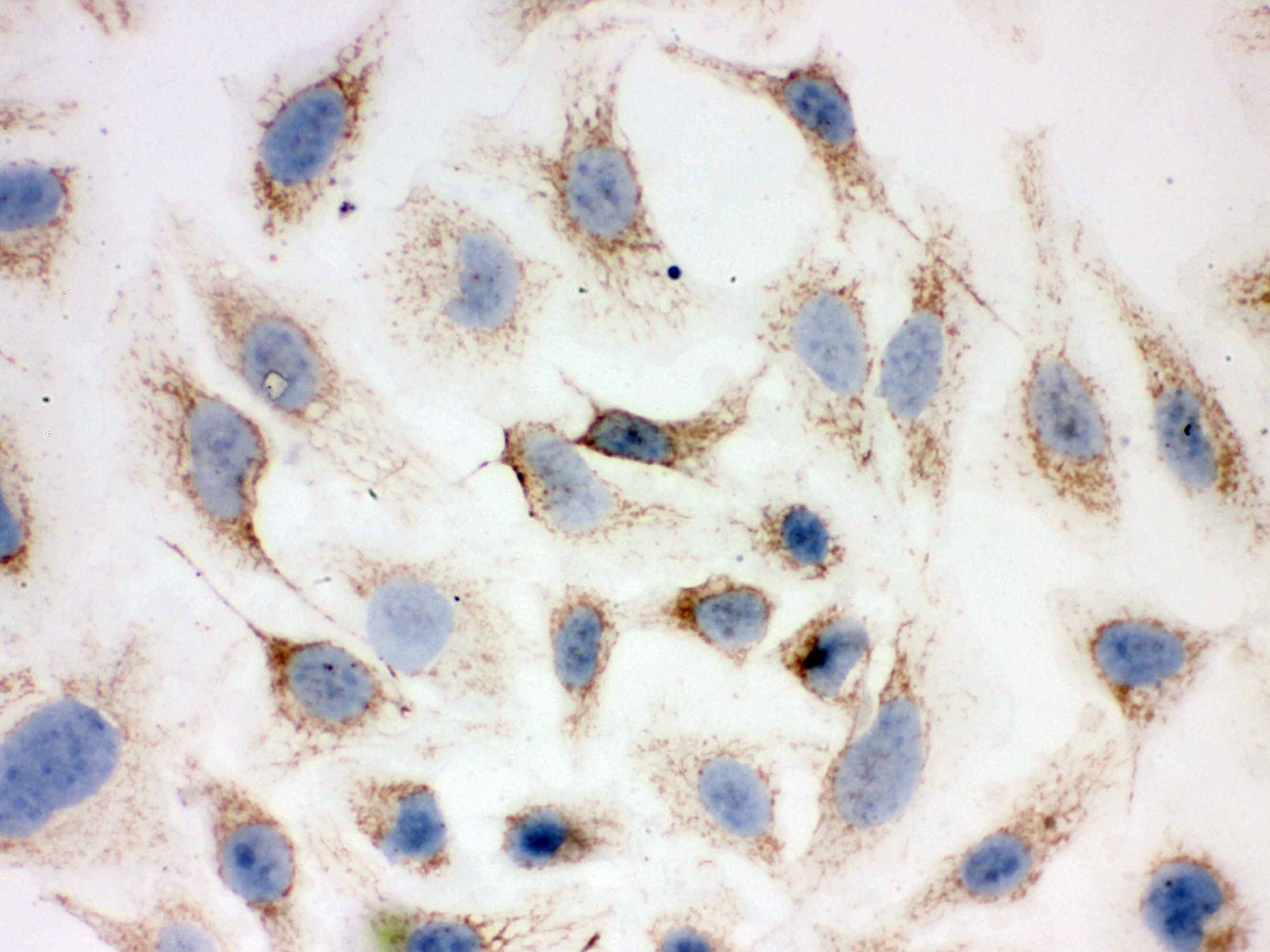 Polyclonal Rabbit anti-Human PRDX3 / Peroxiredoxin 3 Antibody (aa110-256, IHC, WB)
