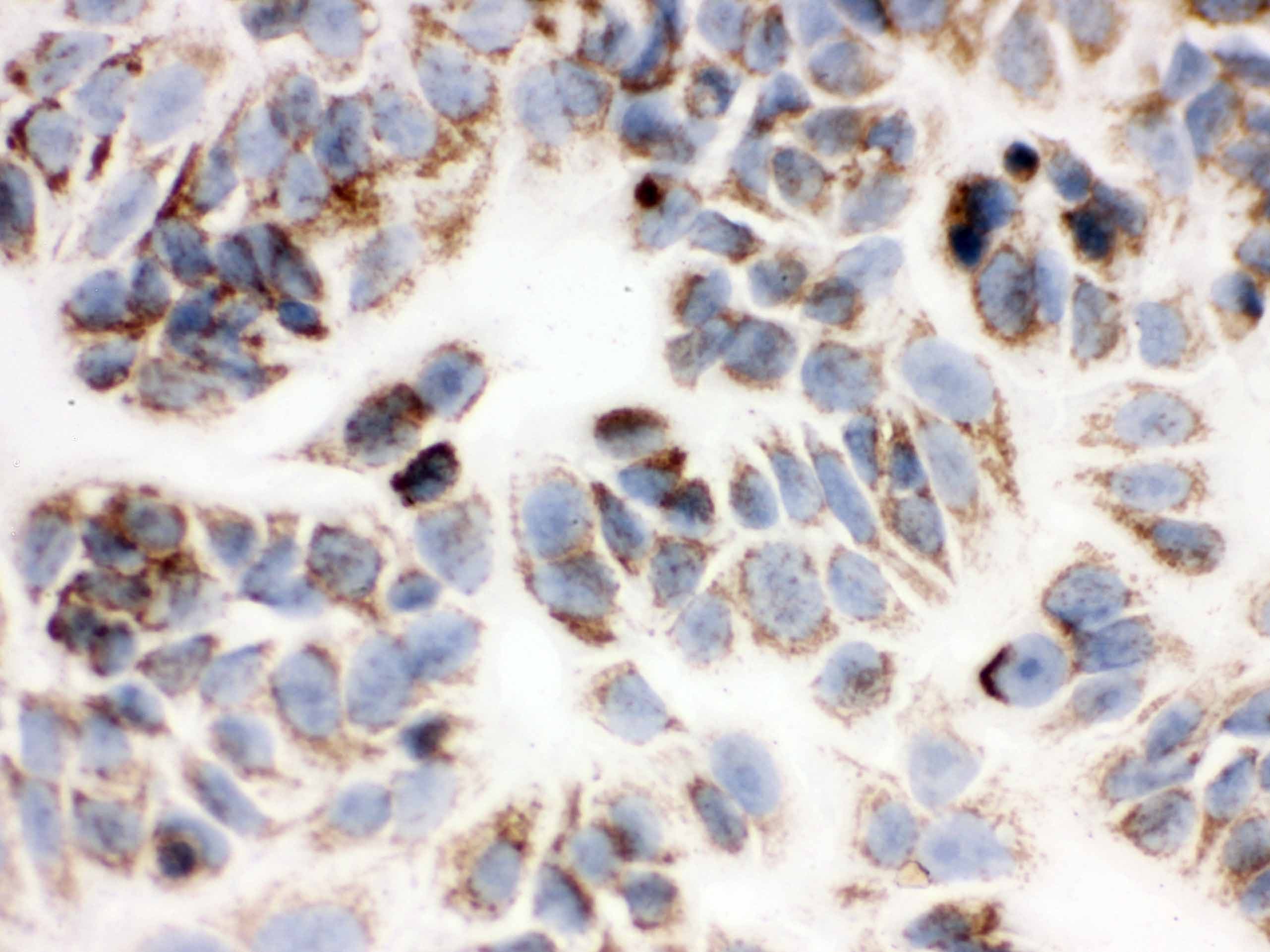 Polyclonal Rabbit anti-Human PRDX3 / Peroxiredoxin 3 Antibody (aa110-256, IHC, WB)