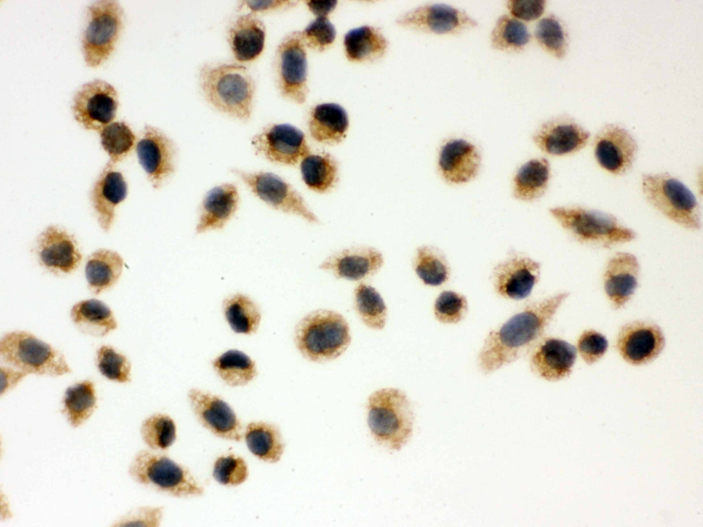 Polyclonal Rabbit anti-Human PRDX3 / Peroxiredoxin 3 Antibody (aa110-256, IHC, WB)
