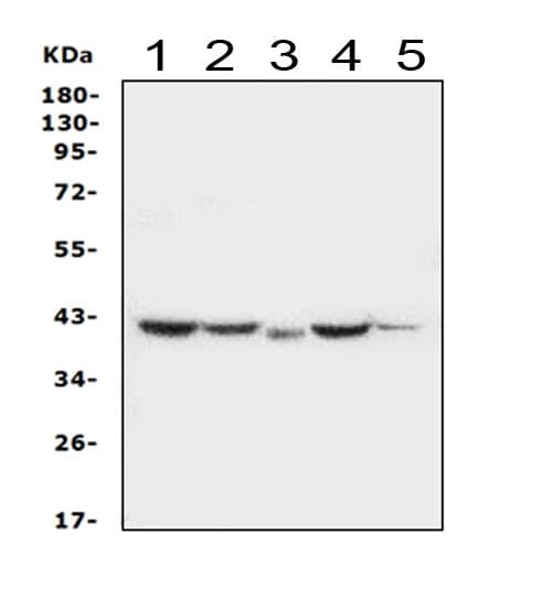 Polyclonal Rabbit anti-Human SERPINB5 / Maspin Antibody (aa1-350, IHC, WB)