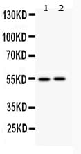 Polyclonal Rabbit anti-Human Vimentin Antibody (aa435-466, IHC, WB)