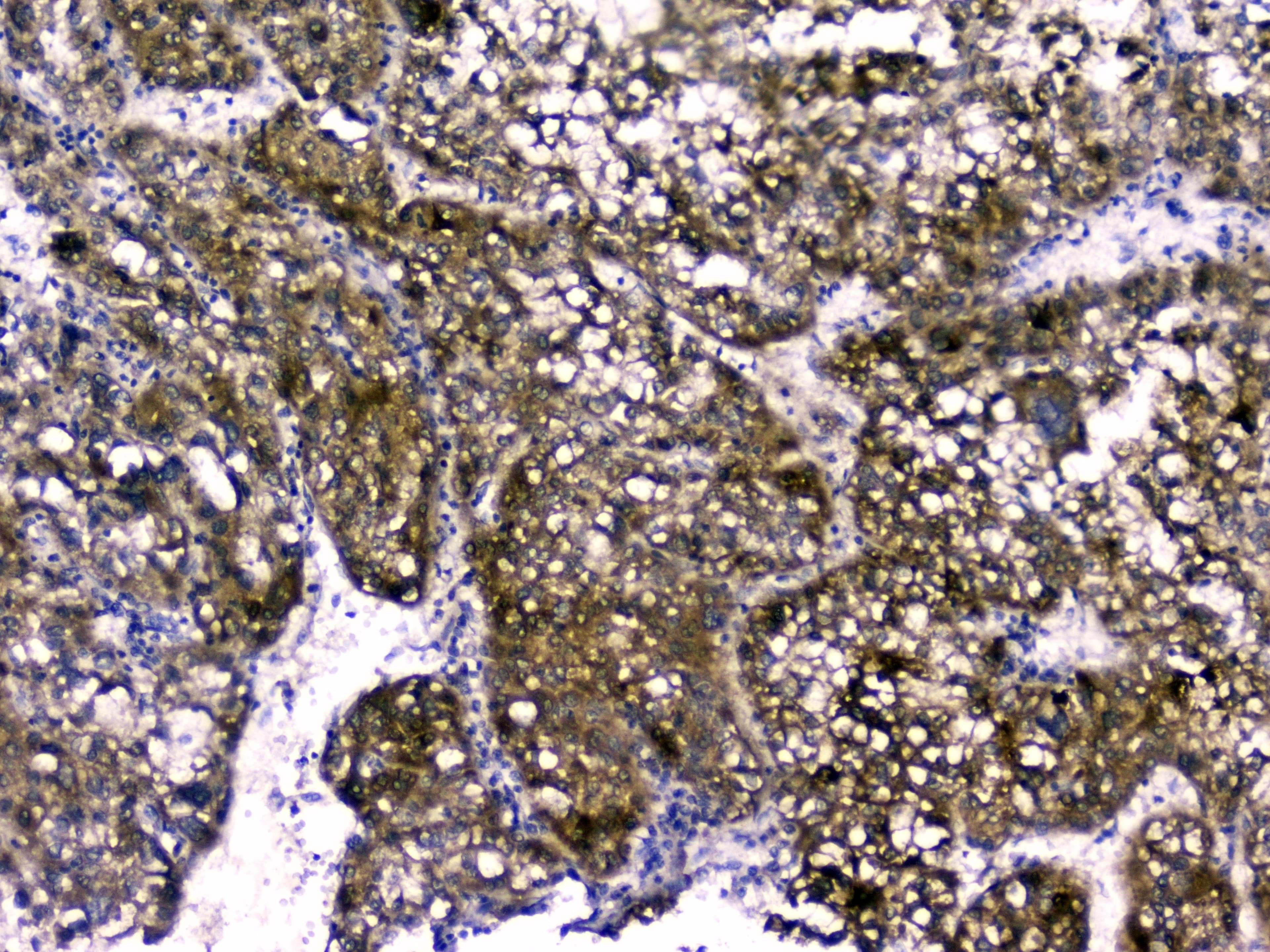 Polyclonal Rabbit anti-Human RBP4 Antibody (WB)