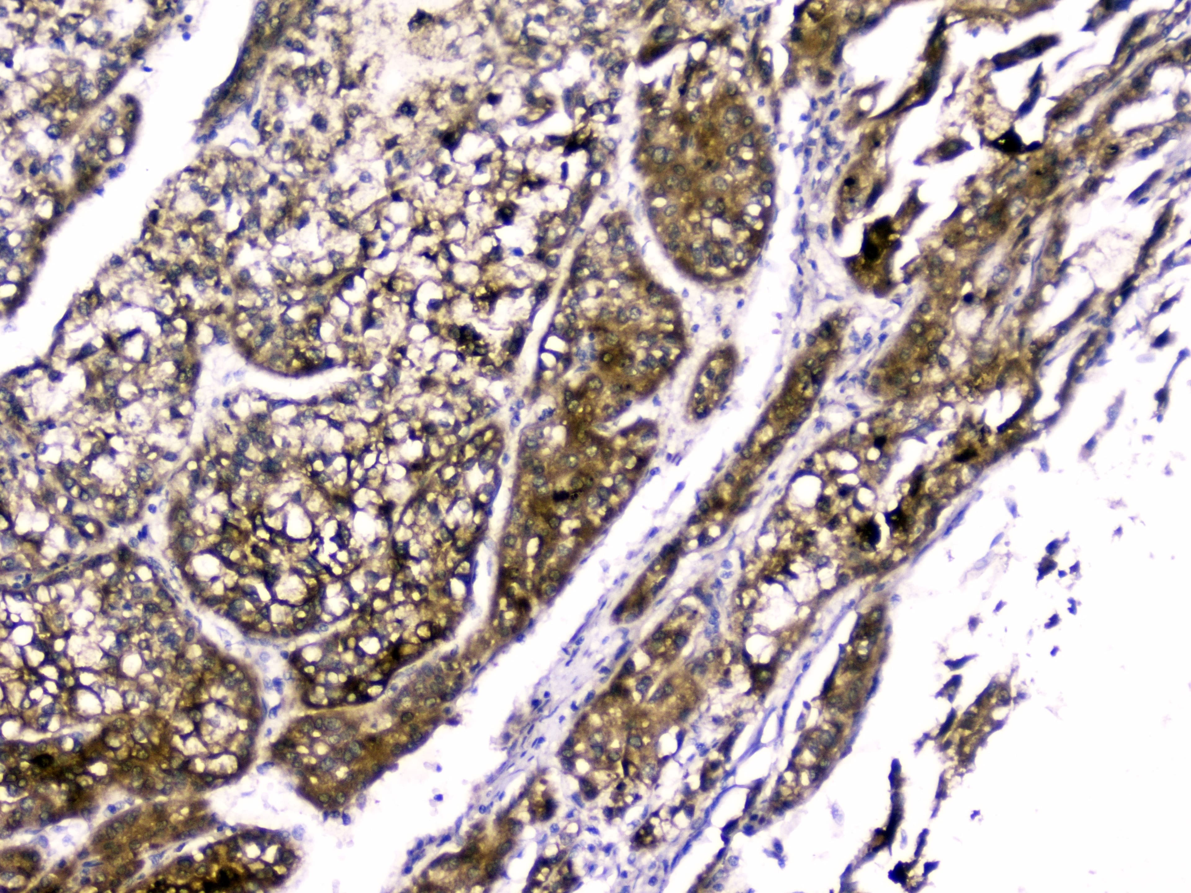 Polyclonal Rabbit anti-Human RBP4 Antibody (WB)
