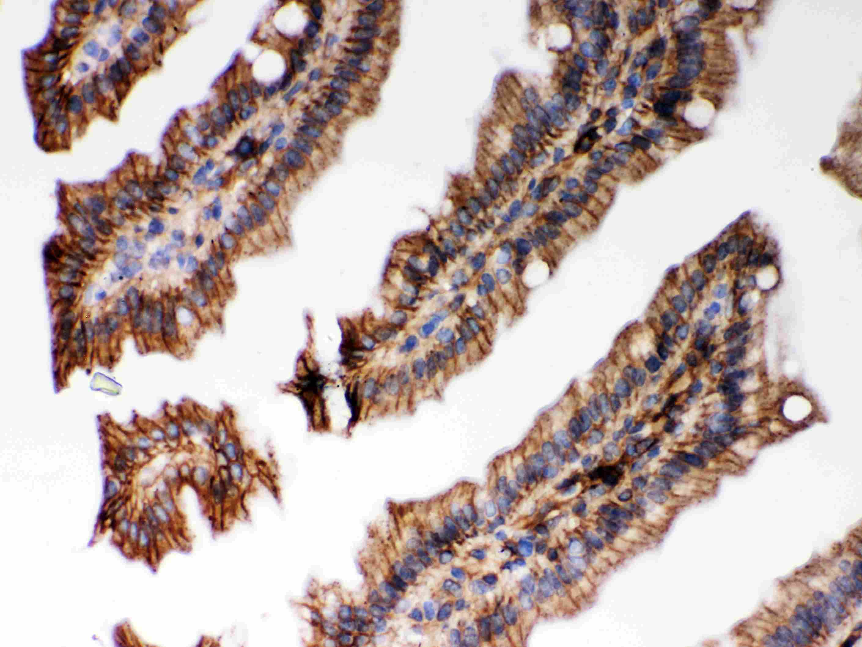 Polyclonal Rabbit anti-Human HLA-C Antibody (aa38-62, IHC, WB)