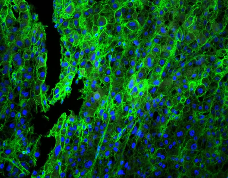 Polyclonal Rabbit anti-Human HLA-C Antibody (aa38-62, IHC, WB)