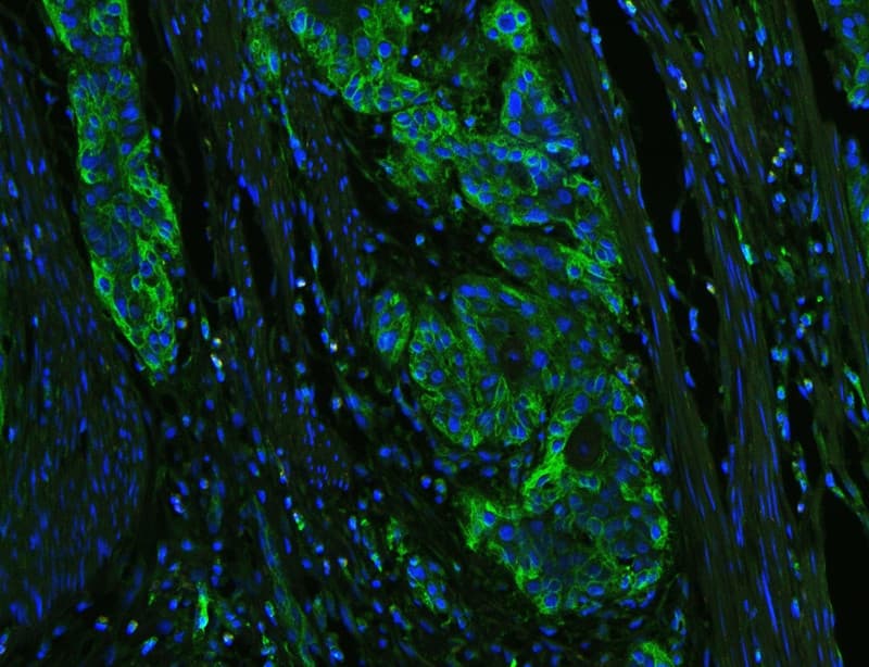 Polyclonal Rabbit anti-Human HLA-C Antibody (aa38-62, IHC, WB)