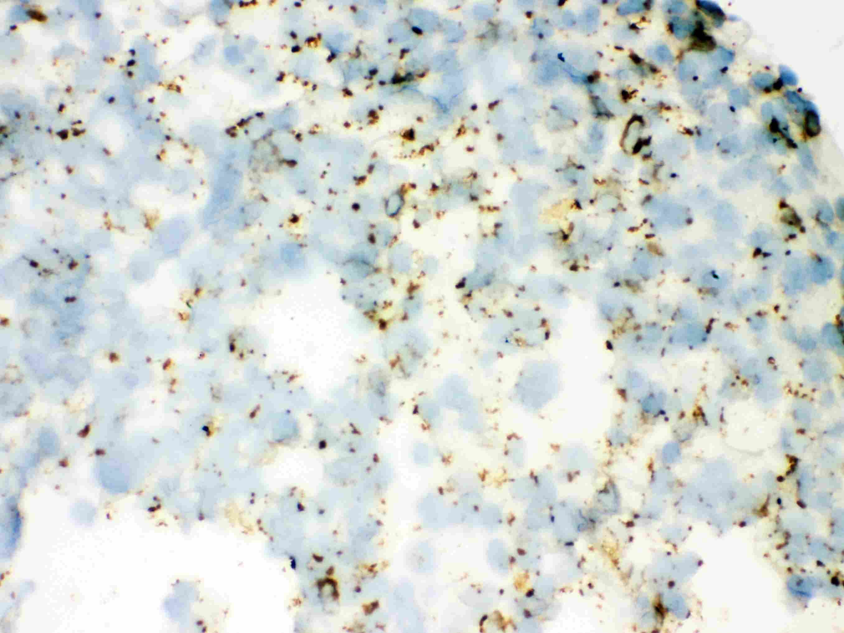 Polyclonal Rabbit anti-Human SFTPA1 + SFTPA2 Antibody (aa206-237, IHC, WB)