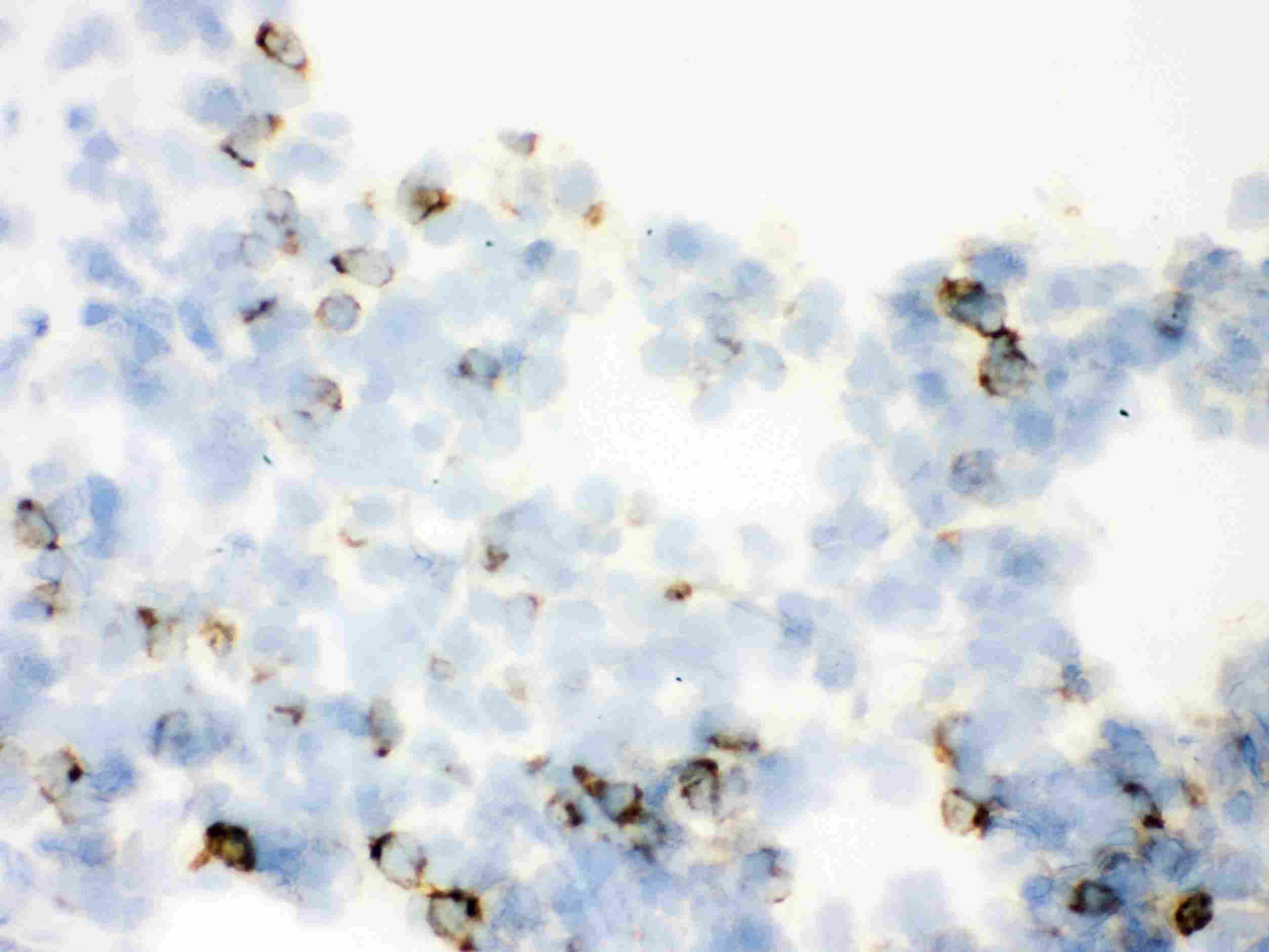 Polyclonal Rabbit anti-Human SFTPA1 + SFTPA2 Antibody (aa206-237, IHC, WB)