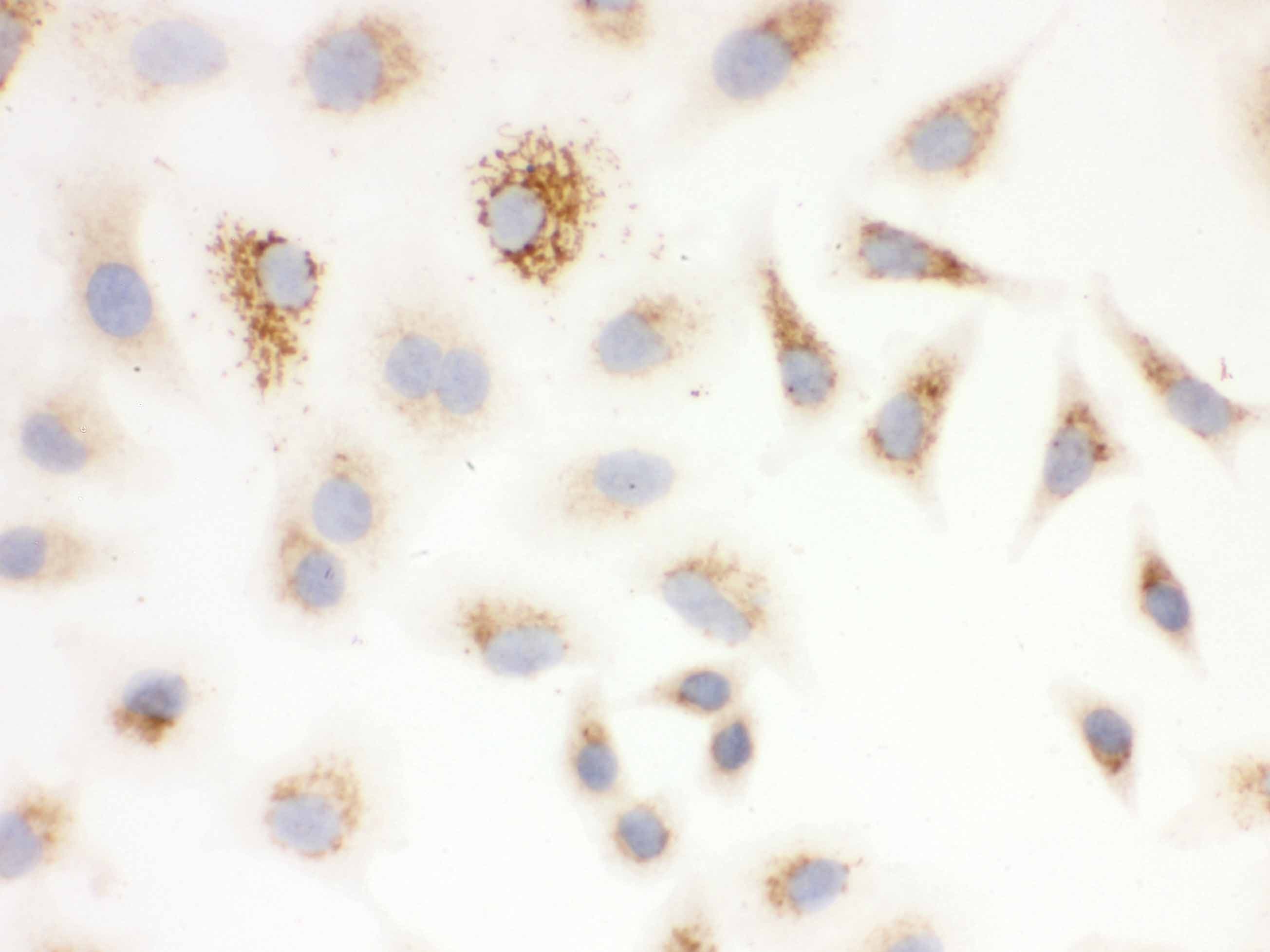 SOD2 / Mn SOD Antibody (aa192-222)