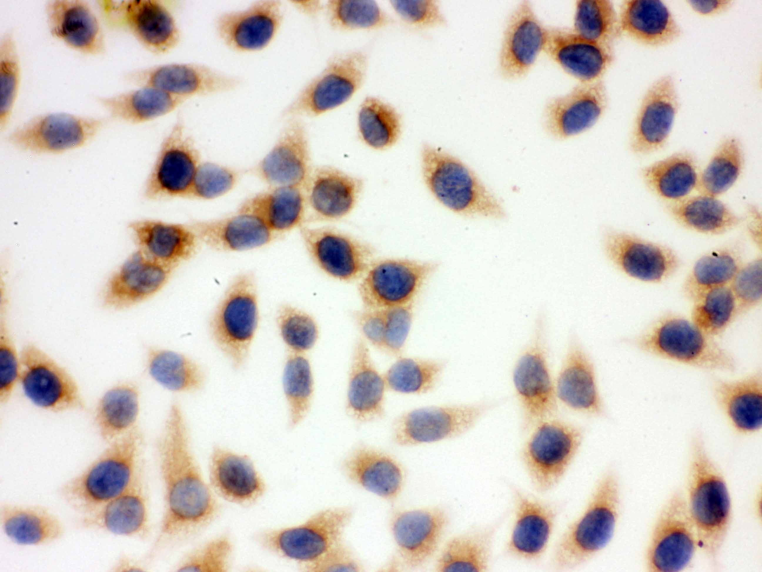 SOD2 / Mn SOD Antibody (aa192-222)