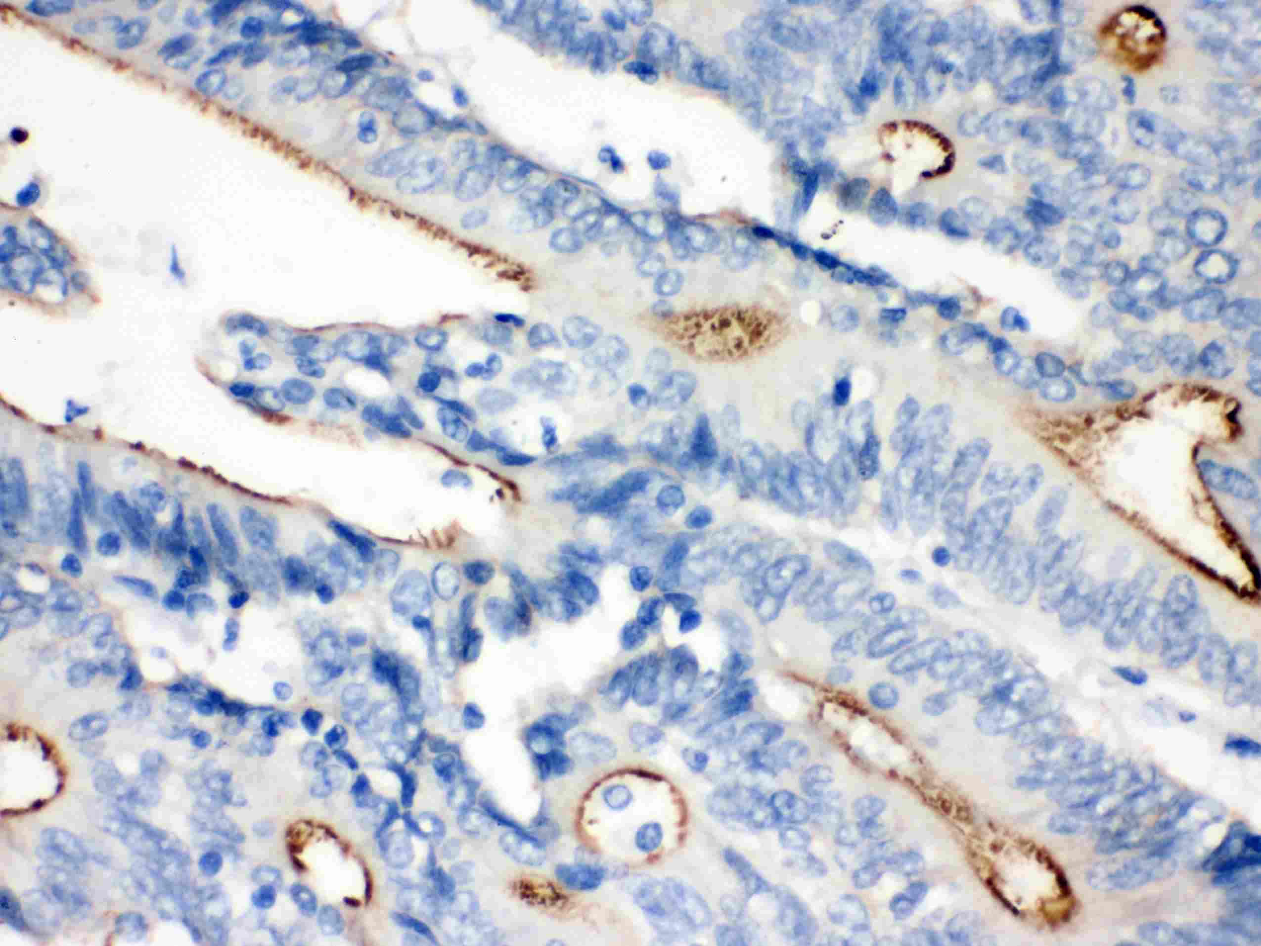Polyclonal Rabbit anti-Human VIL1 / Villin Antibody (aa770-799, IHC, WB)
