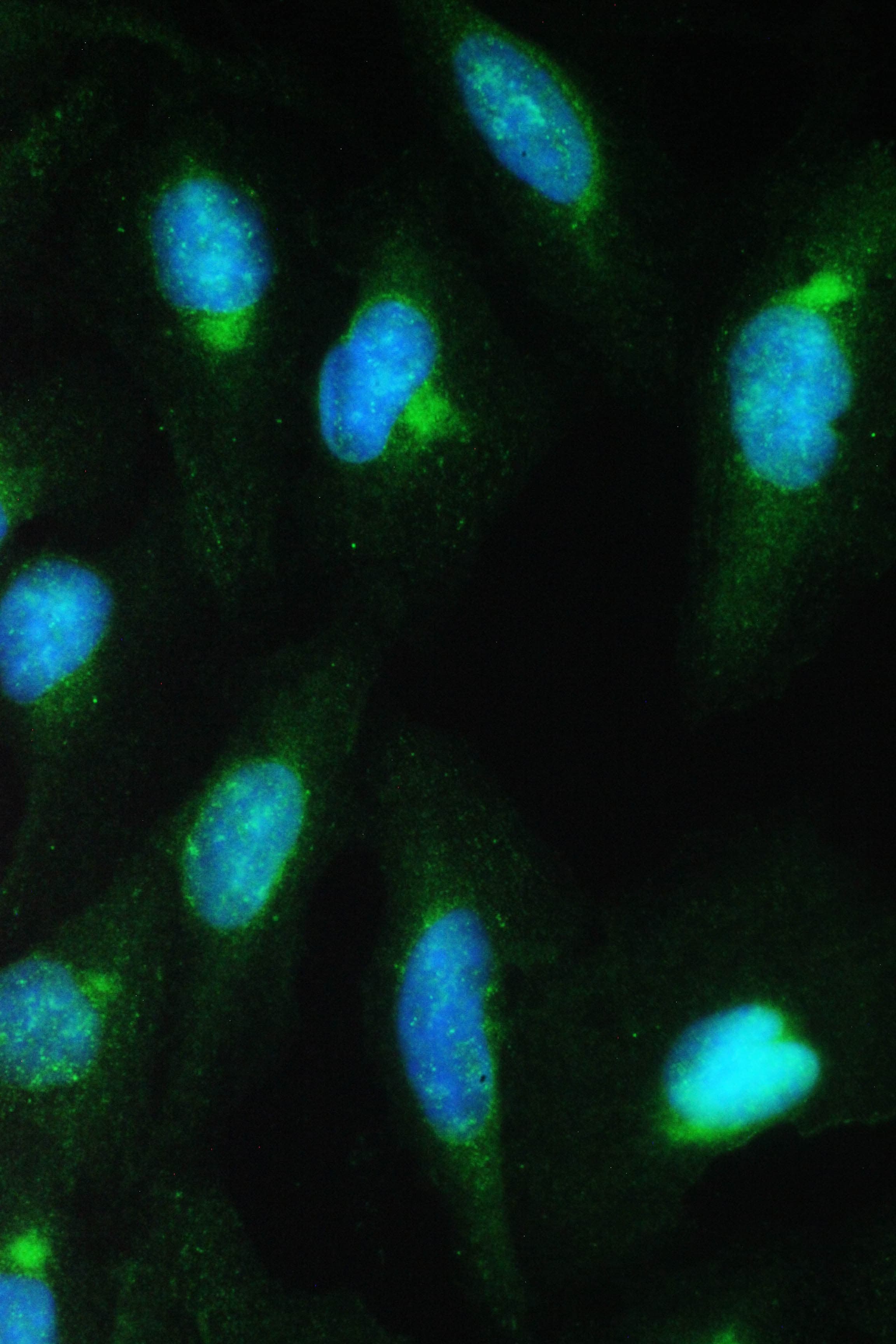 Polyclonal Rabbit anti-Human CDK2 Antibody (aa81-298, IHC, WB)