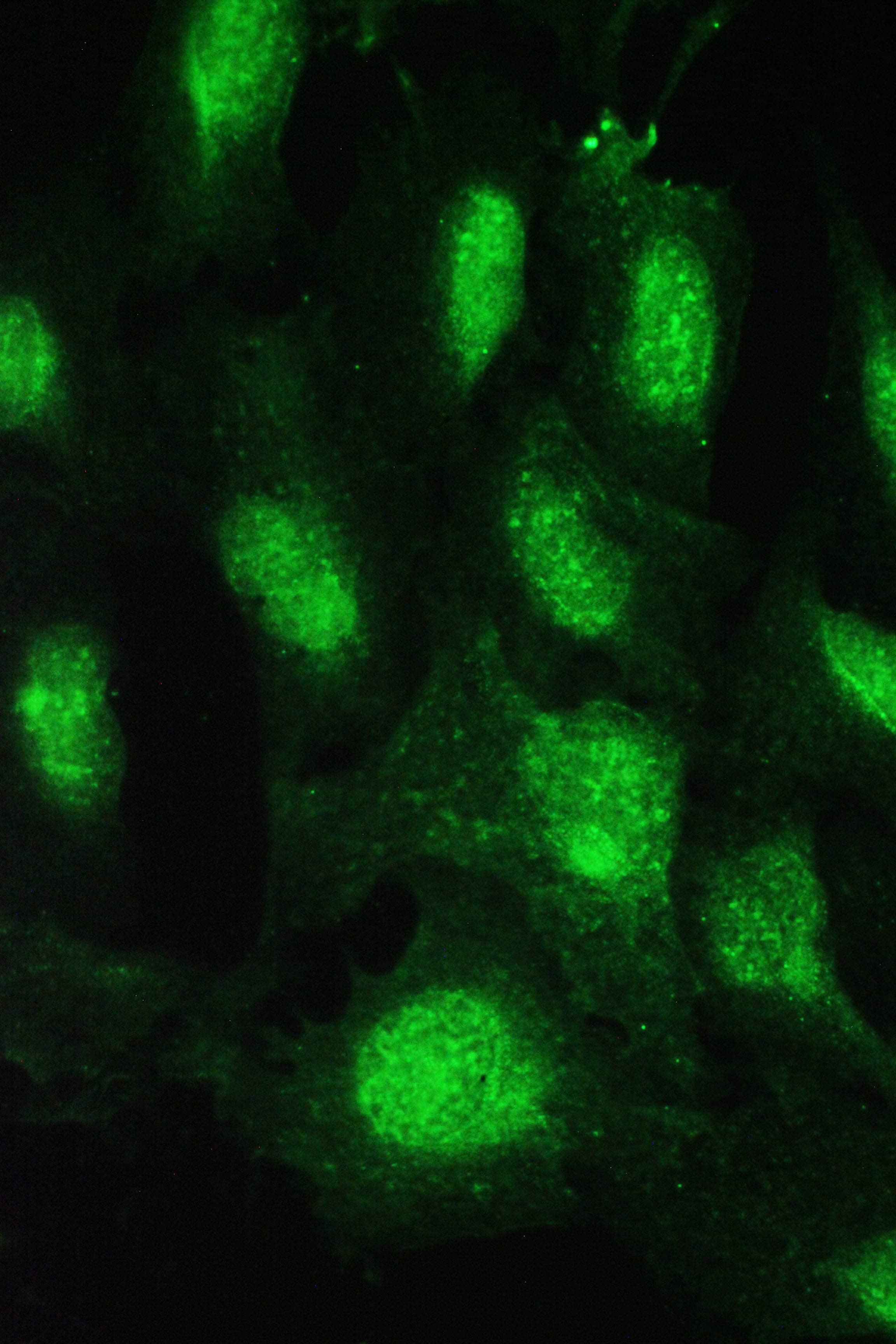 Polyclonal Rabbit anti-Human CDK2 Antibody (aa81-298, IHC, WB)