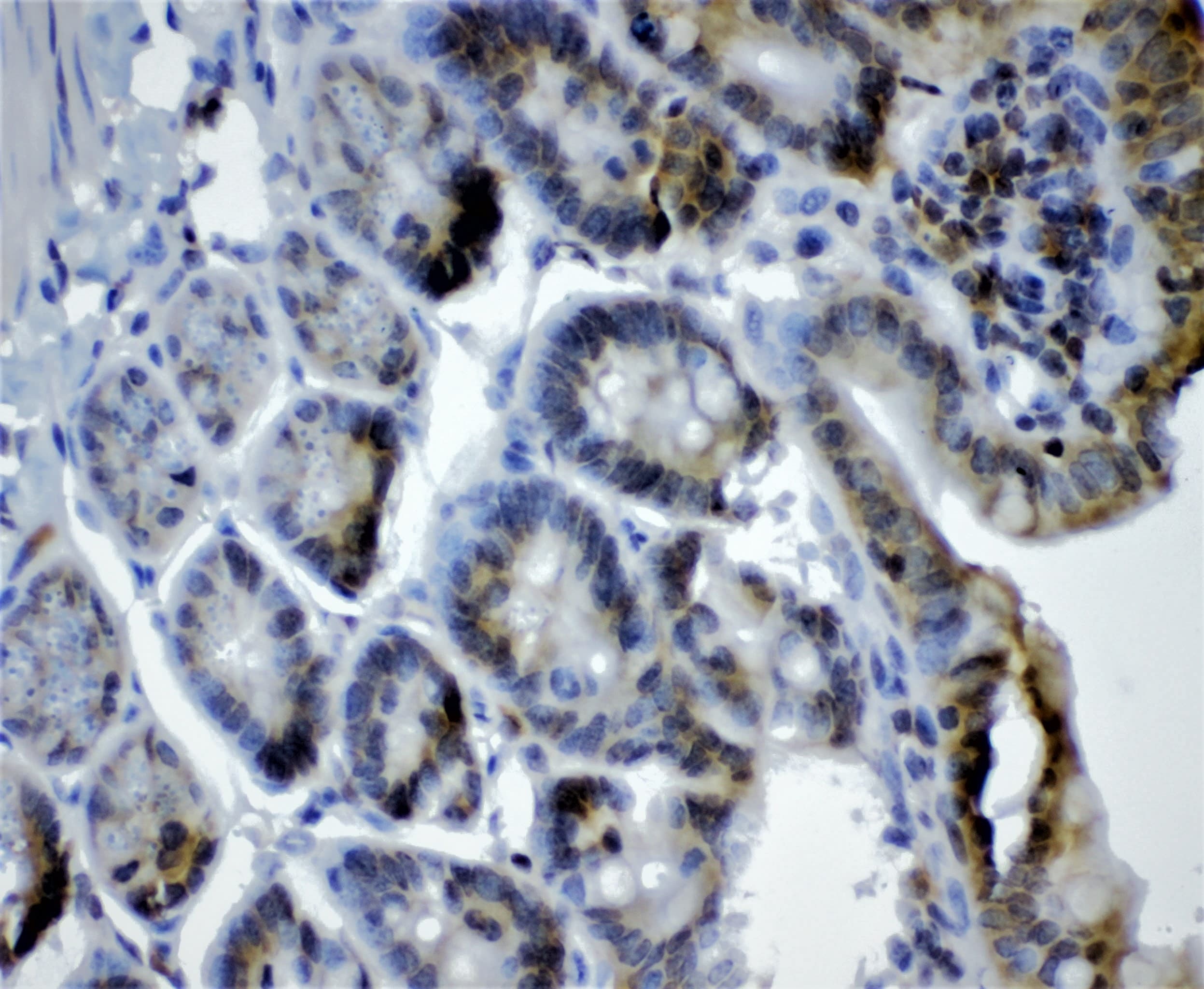 Polyclonal Rabbit anti-Human CRY1 Antibody (aa153-189, WB)