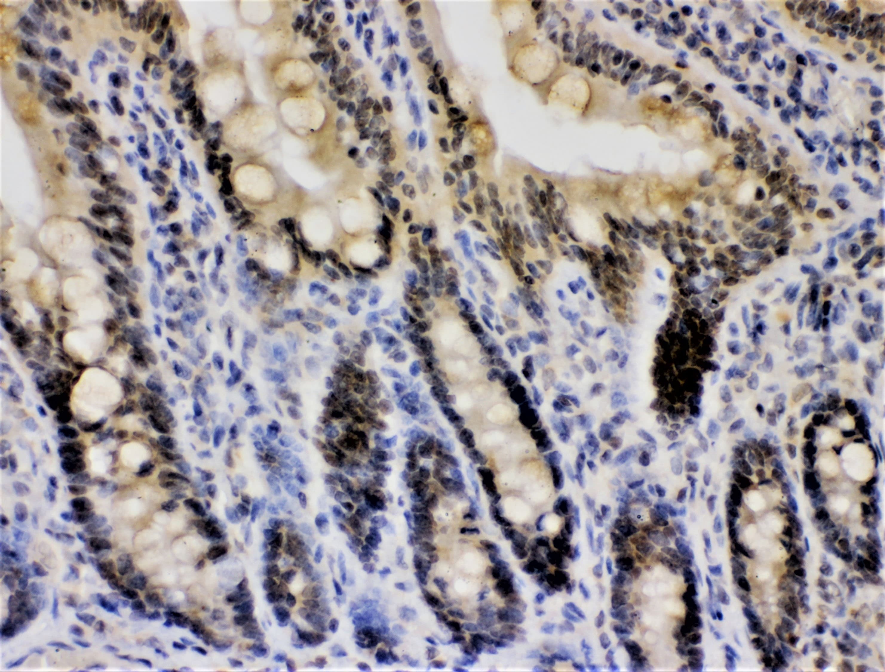 Polyclonal Rabbit anti-Human CRY1 Antibody (aa153-189, WB)