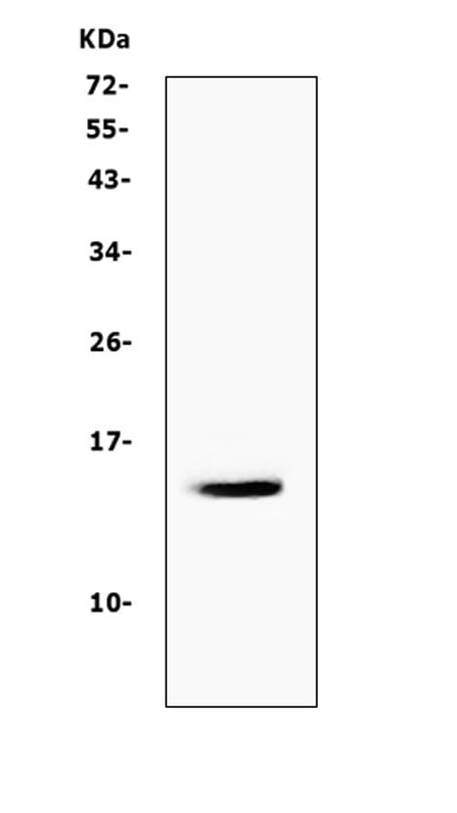 Polyclonal Rabbit anti-Human CSTA / Cystatin A Antibody (aa8-98, IHC, WB)