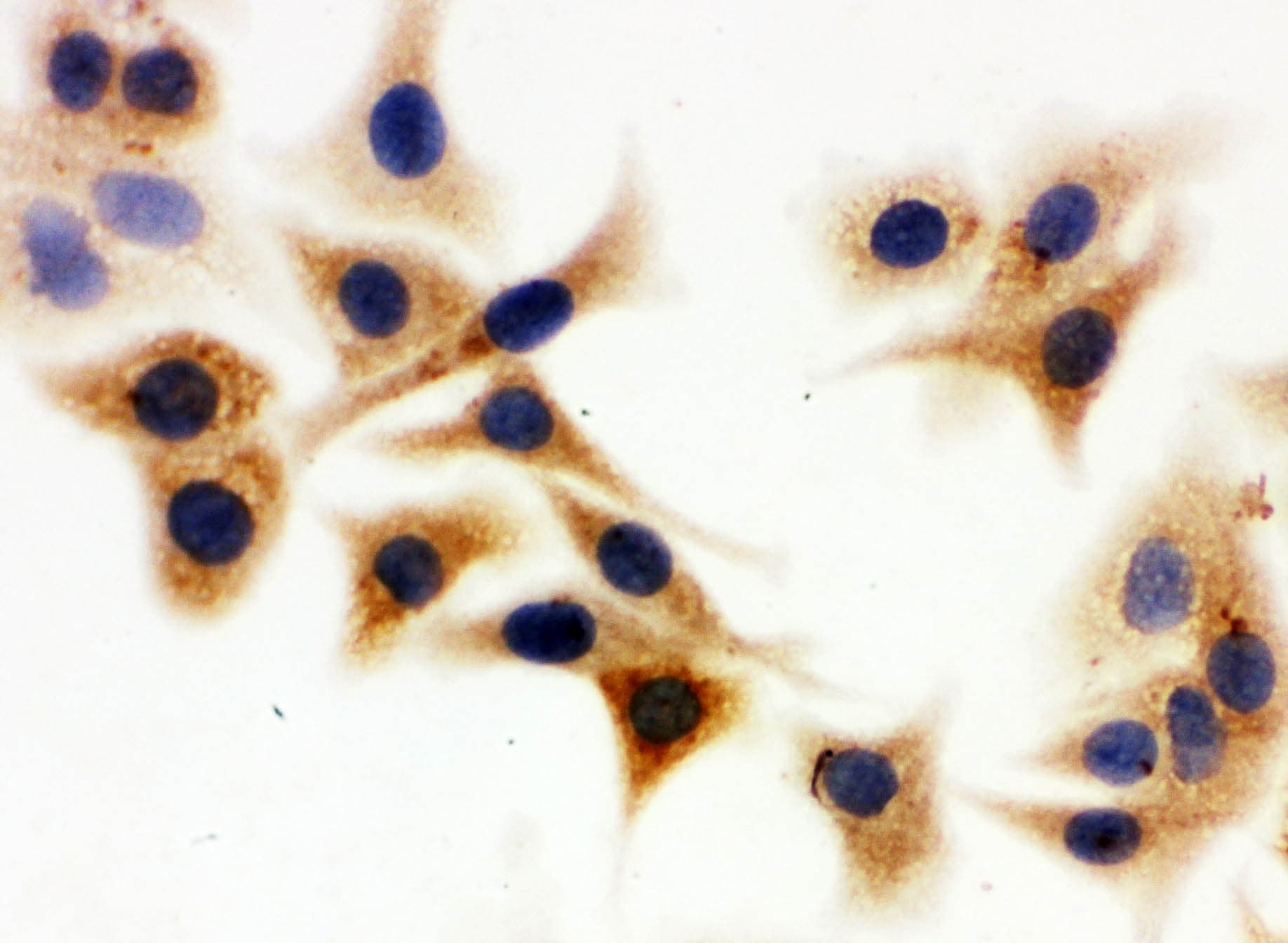 Polyclonal Rabbit anti-Human IDH1 / IDH Antibody (aa381-413, IHC, WB)