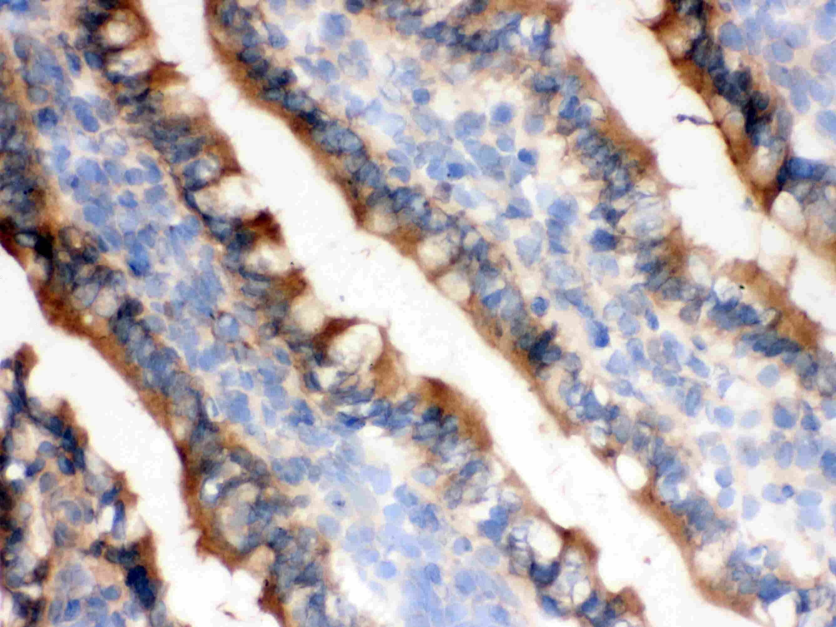Polyclonal Rabbit anti-Human IDH1 / IDH Antibody (aa381-413, IHC, WB)