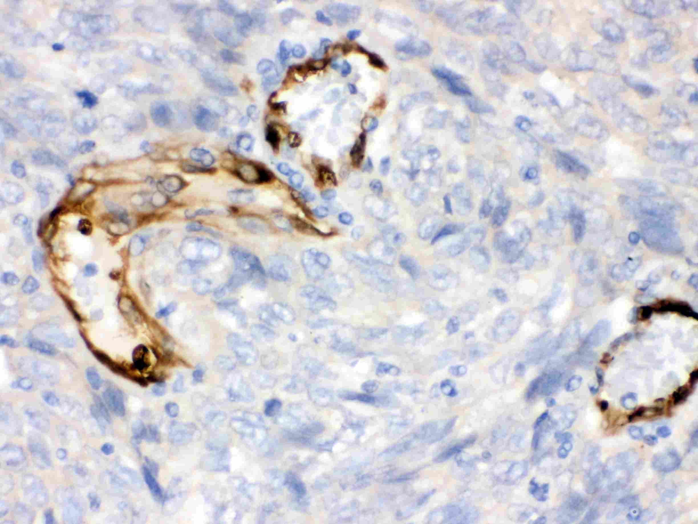 Polyclonal Rabbit anti-Human IDO1 / IDO Antibody (aa37-69, IHC, WB)