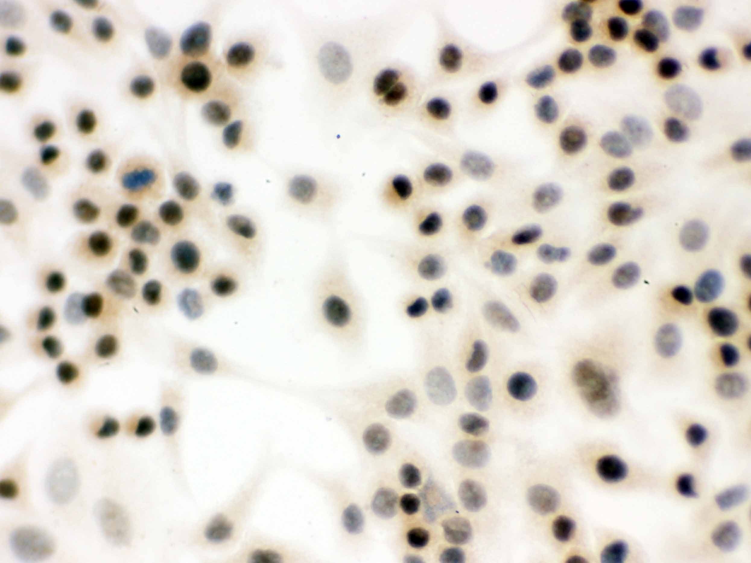 Polyclonal Rabbit anti-Human NBN / Nibrin Antibody (aa714-745, IHC, WB)