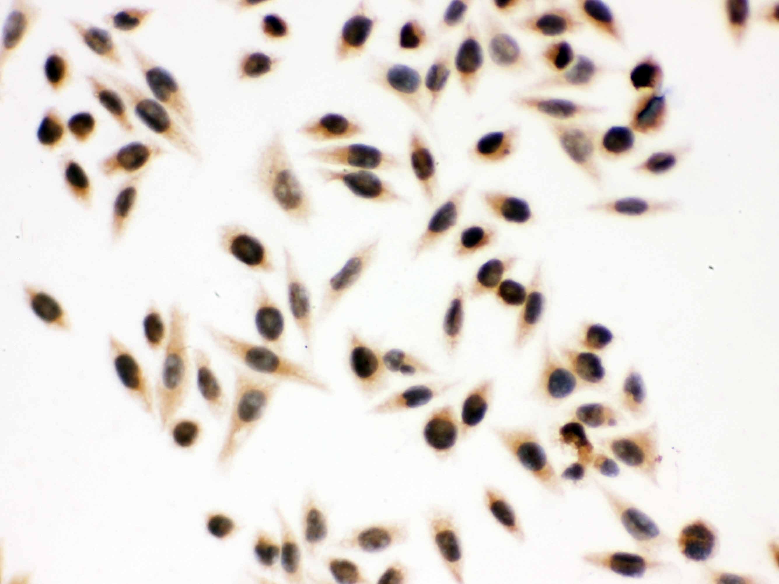 Polyclonal Rabbit anti-Human NBN / Nibrin Antibody (aa714-745, IHC, WB)