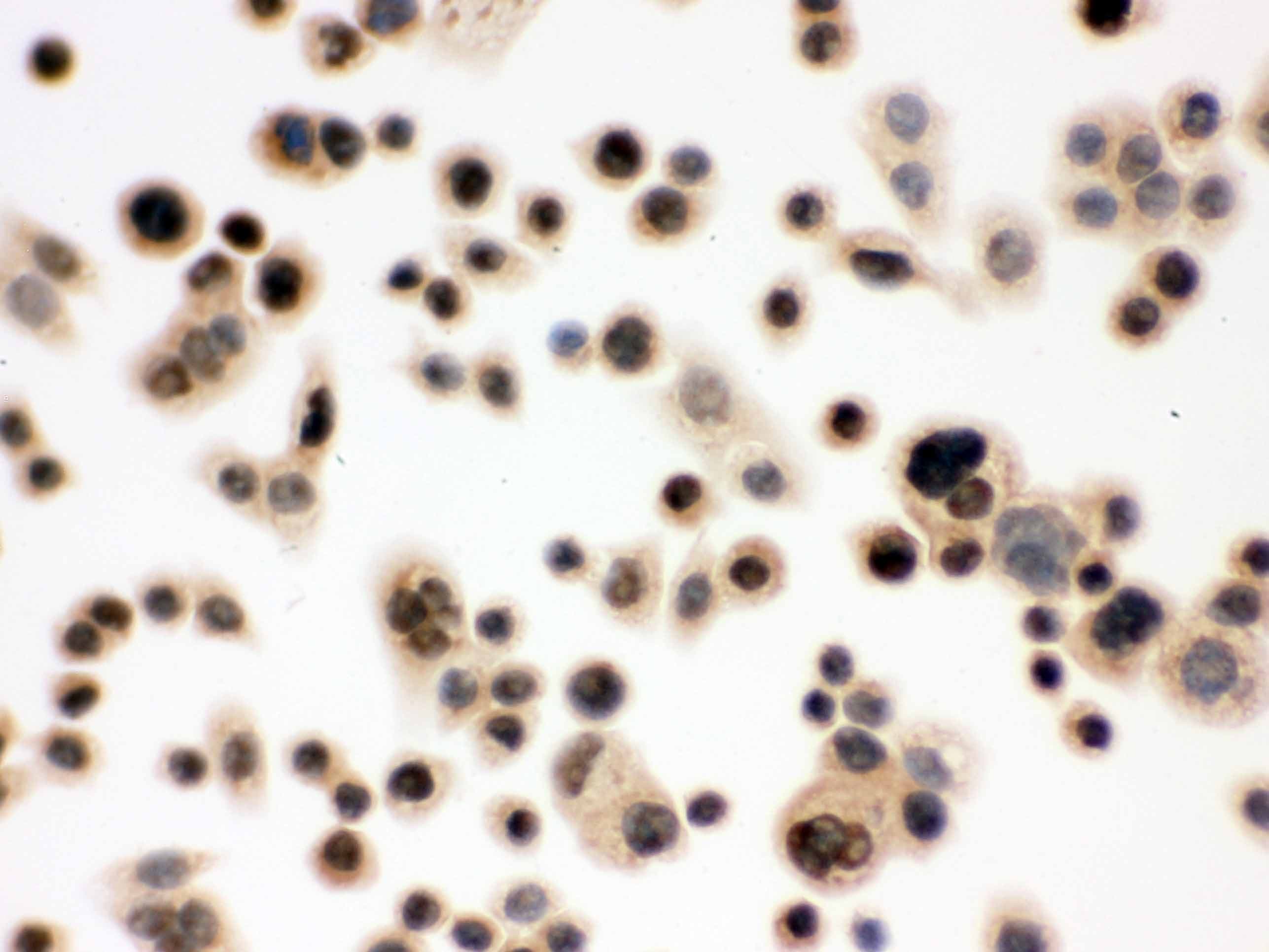 Polyclonal Rabbit anti-Human NBN / Nibrin Antibody (aa714-745, IHC, WB)