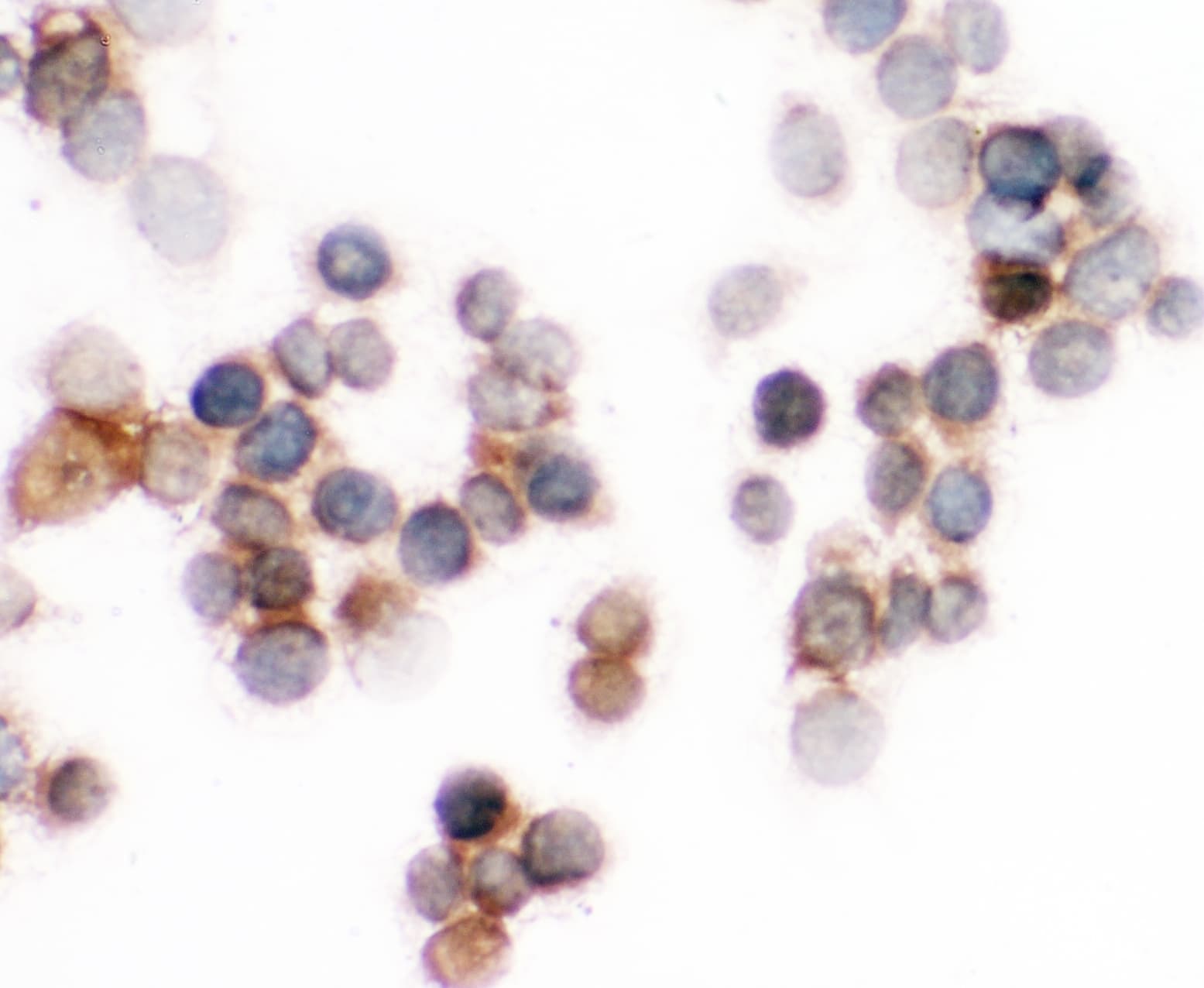 S100A6 / Calcyclin Antibody (aa1-90)