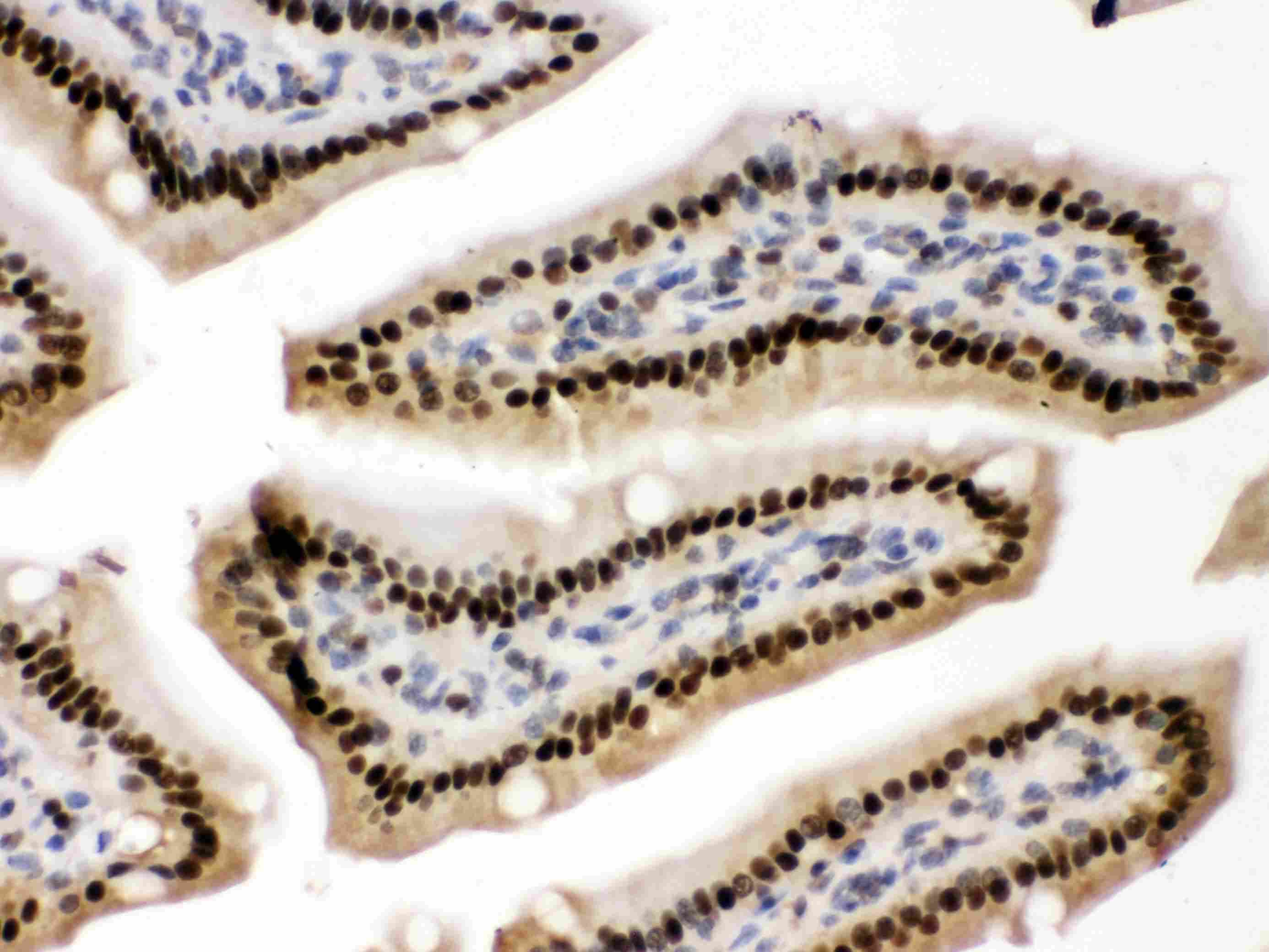 Polyclonal Rabbit anti-Human PRKAB2 / AMPK Beta 2 Antibody (aa56-89, IHC, WB)