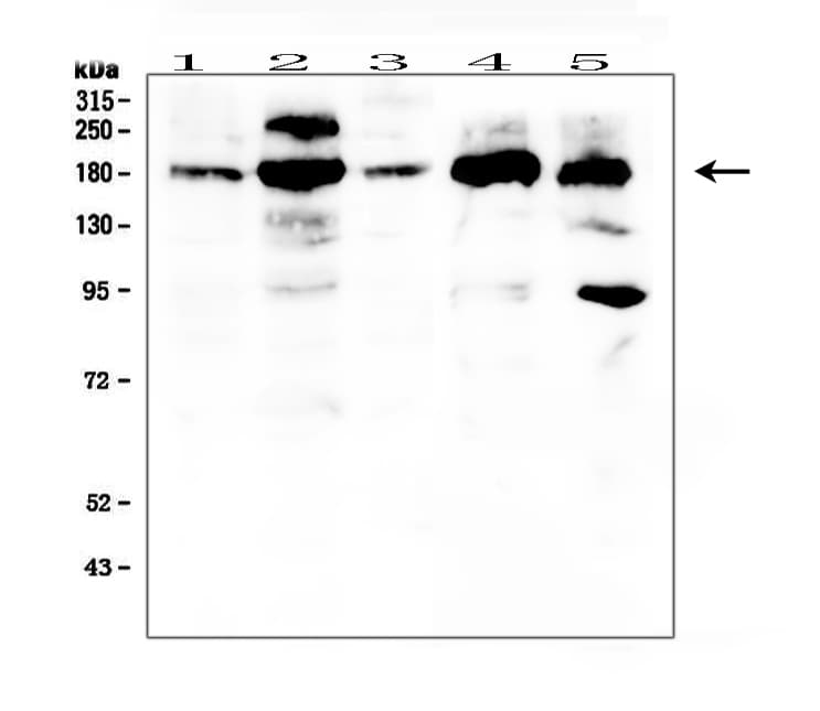PDGFRA / PDGFR Alpha Antibody (aa968-1002)
