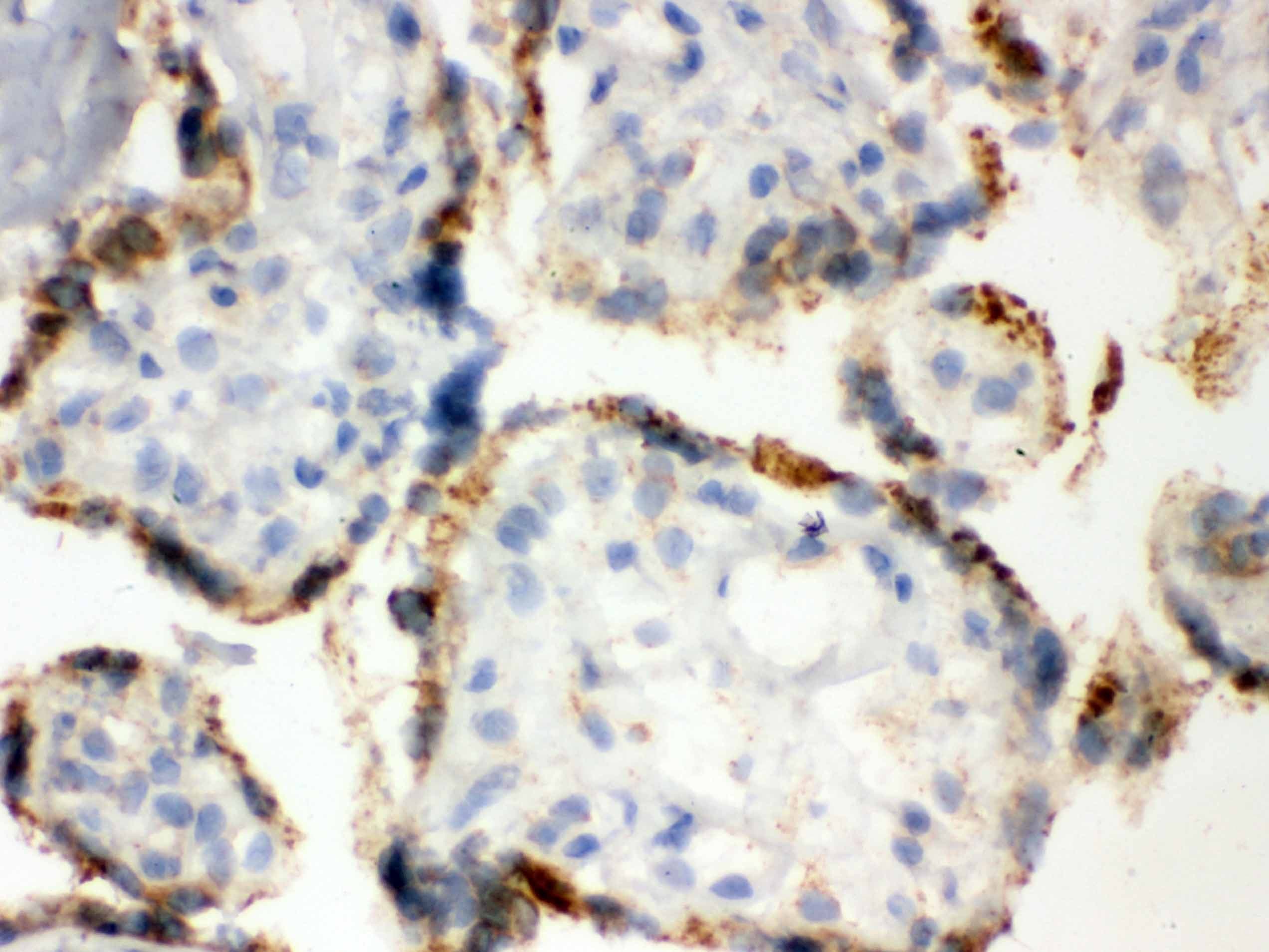 Polyclonal Rabbit anti-Human PDIA3 / ERp57 Antibody (aa471-505, IHC, WB)