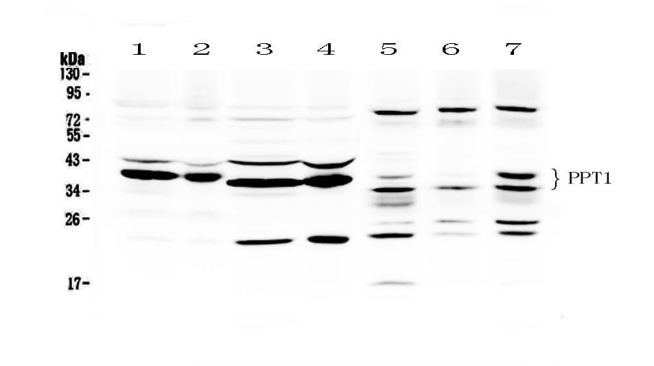 Polyclonal Rabbit anti-Human PPT1 / CLN1 Antibody (aa191-224, IHC, WB)