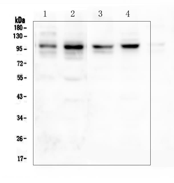 Polyclonal Rabbit anti-Human DLG4 / PSD95 Antibody (aa581-724, IHC, WB)