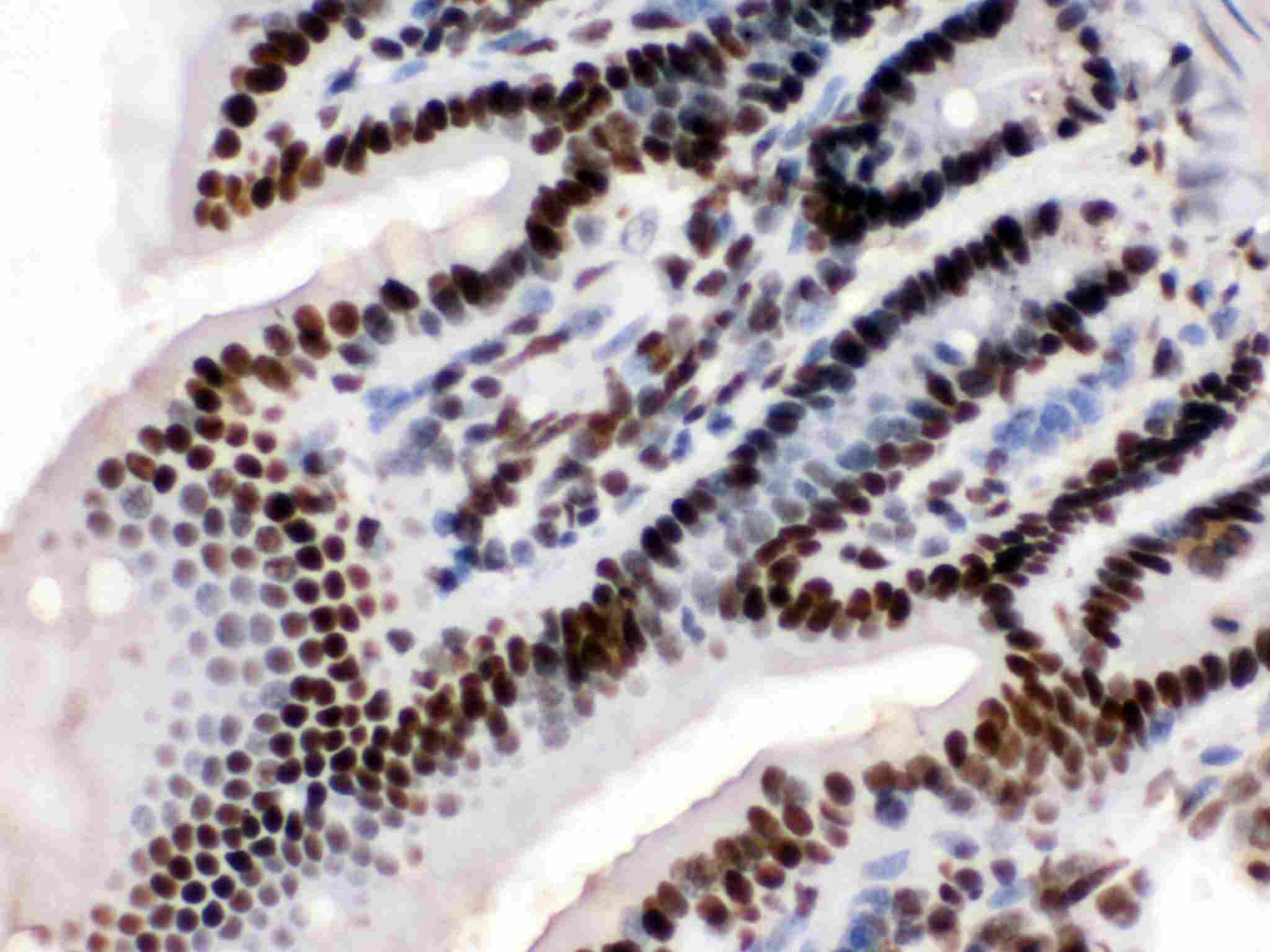 Polyclonal Rabbit anti-Human TRIM28 / KAP1 Antibody (aa699-835, IHC, WB)