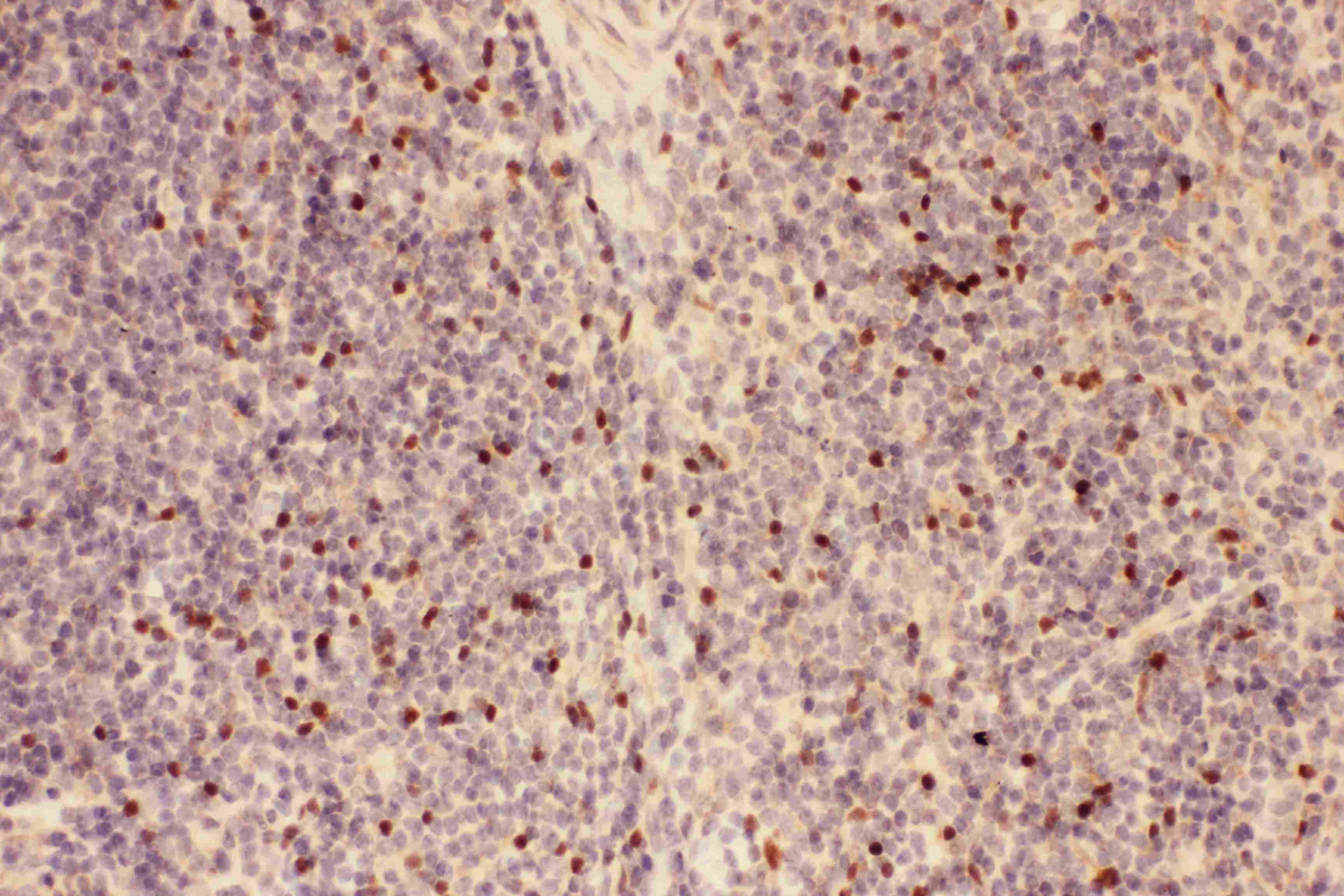 Polyclonal Rabbit anti-Human FOXP3 Antibody (aa101-431, IHC)