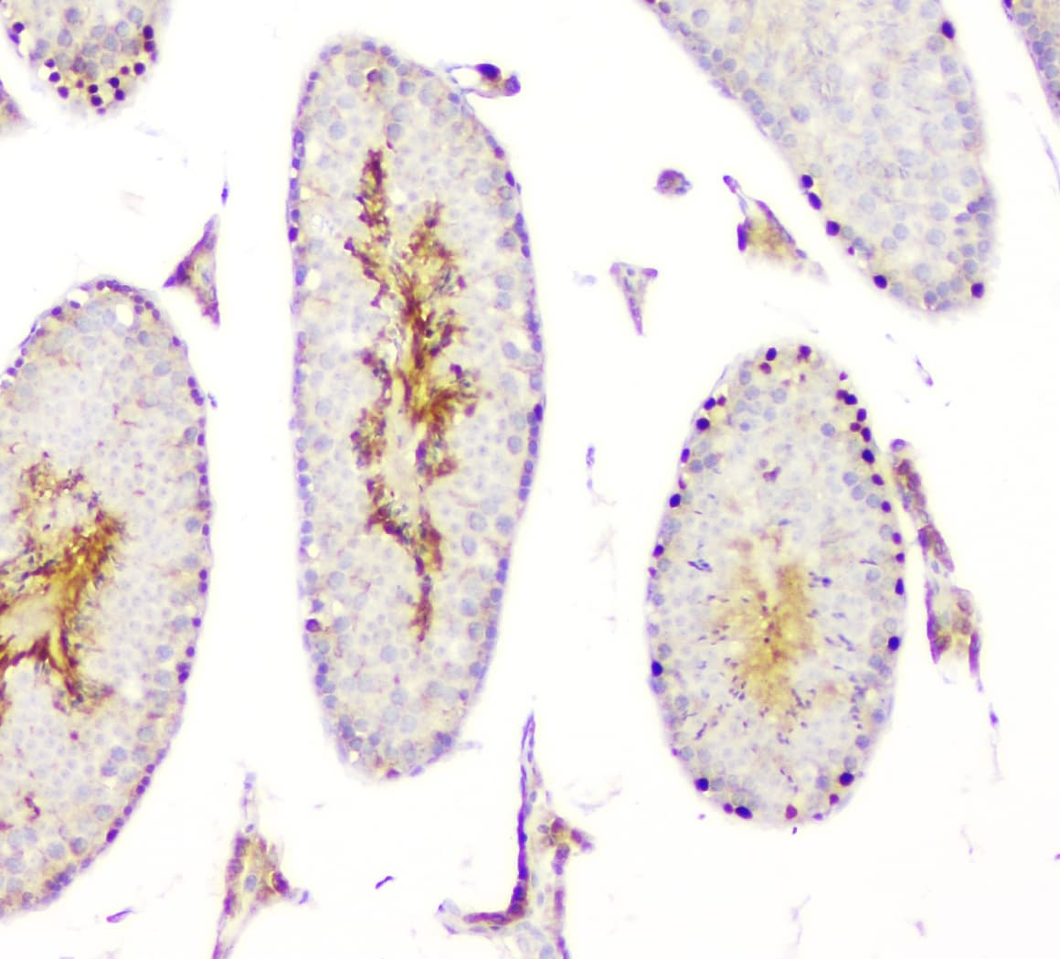 Polyclonal Rabbit anti-Human DMRT1 Antibody (aa98-128, IHC, WB)