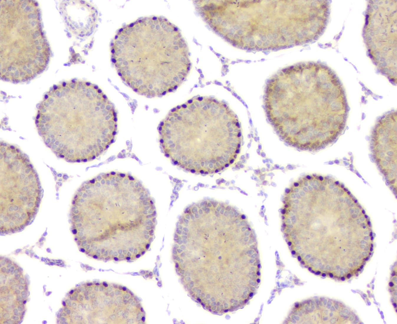 Polyclonal Rabbit anti-Human DMRT1 Antibody (aa98-128, IHC, WB)