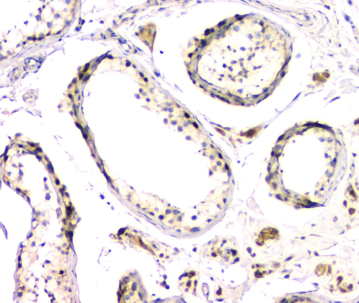 Polyclonal Rabbit anti-Human DMRT1 Antibody (aa98-128, IHC, WB)