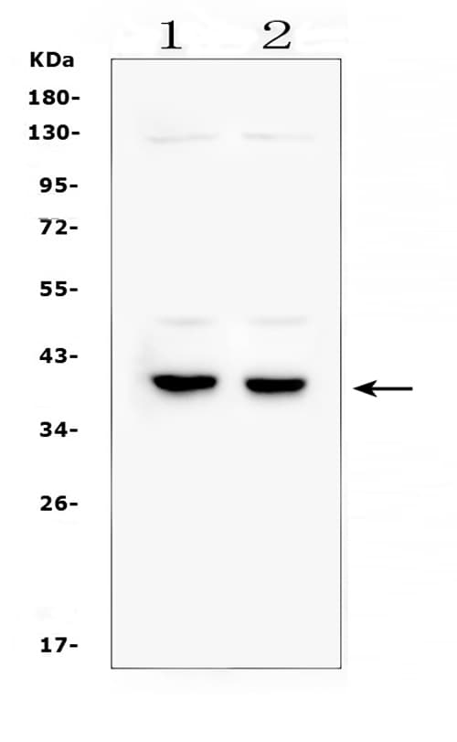 Polyclonal Rabbit anti-Human DMRT1 Antibody (aa98-128, IHC, WB)