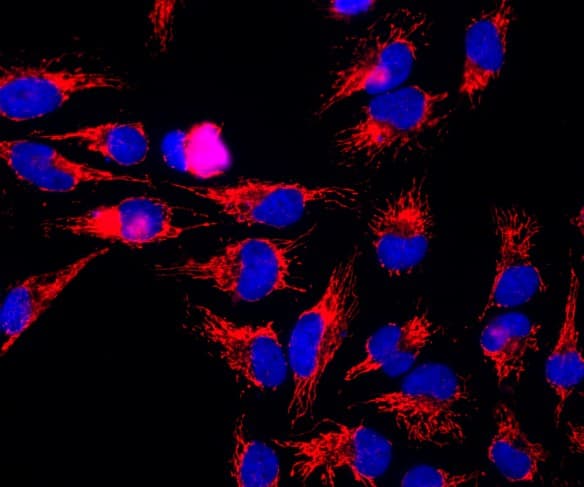 HSPD1 / HSP60 Antibody (clone 1C7)