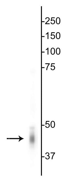 Polyclonal Rabbit anti-Mouse GABRG2 Antibody (IHC, IF, WB)