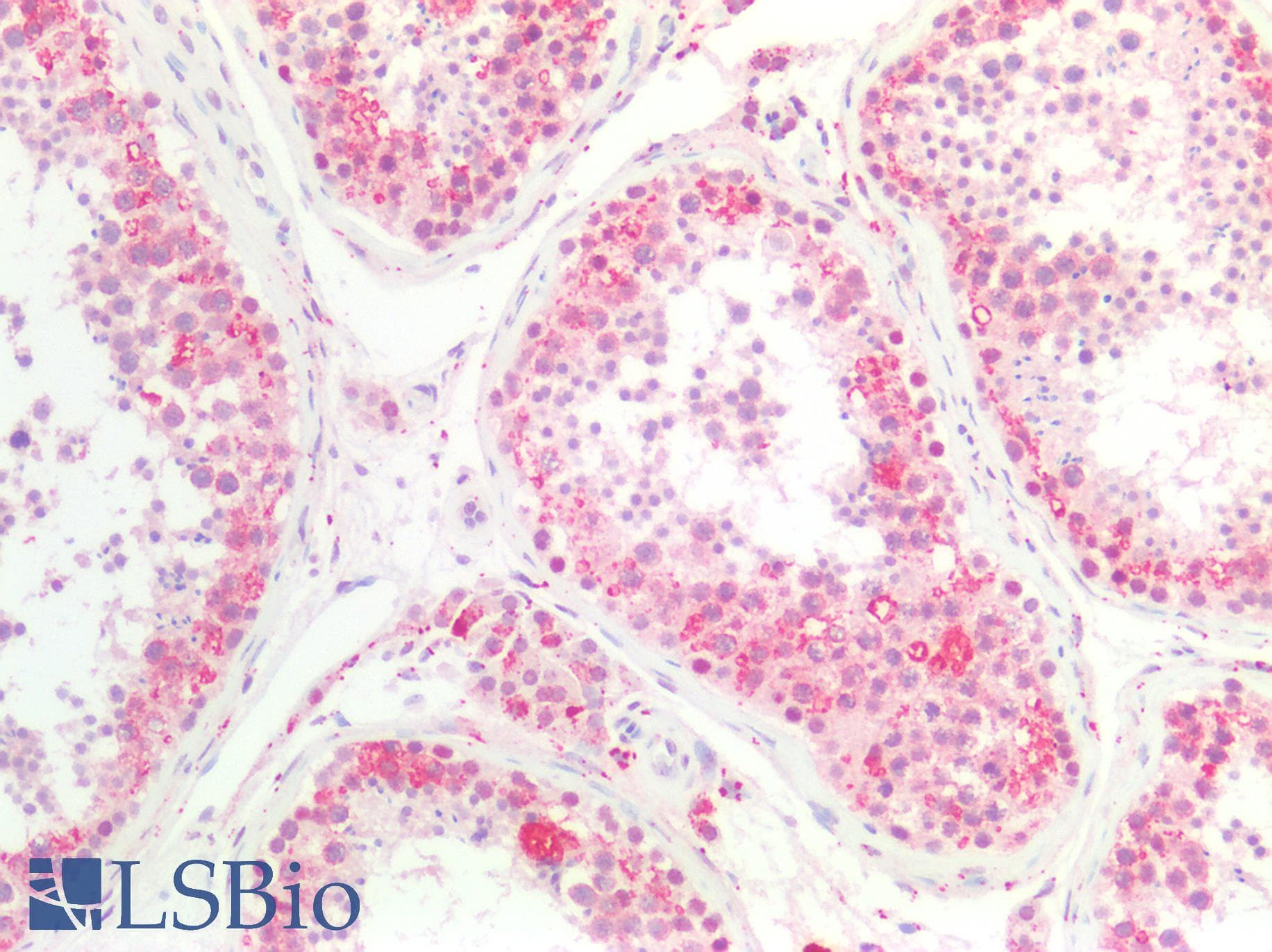 Metallothionein Antibody (N-Terminus)