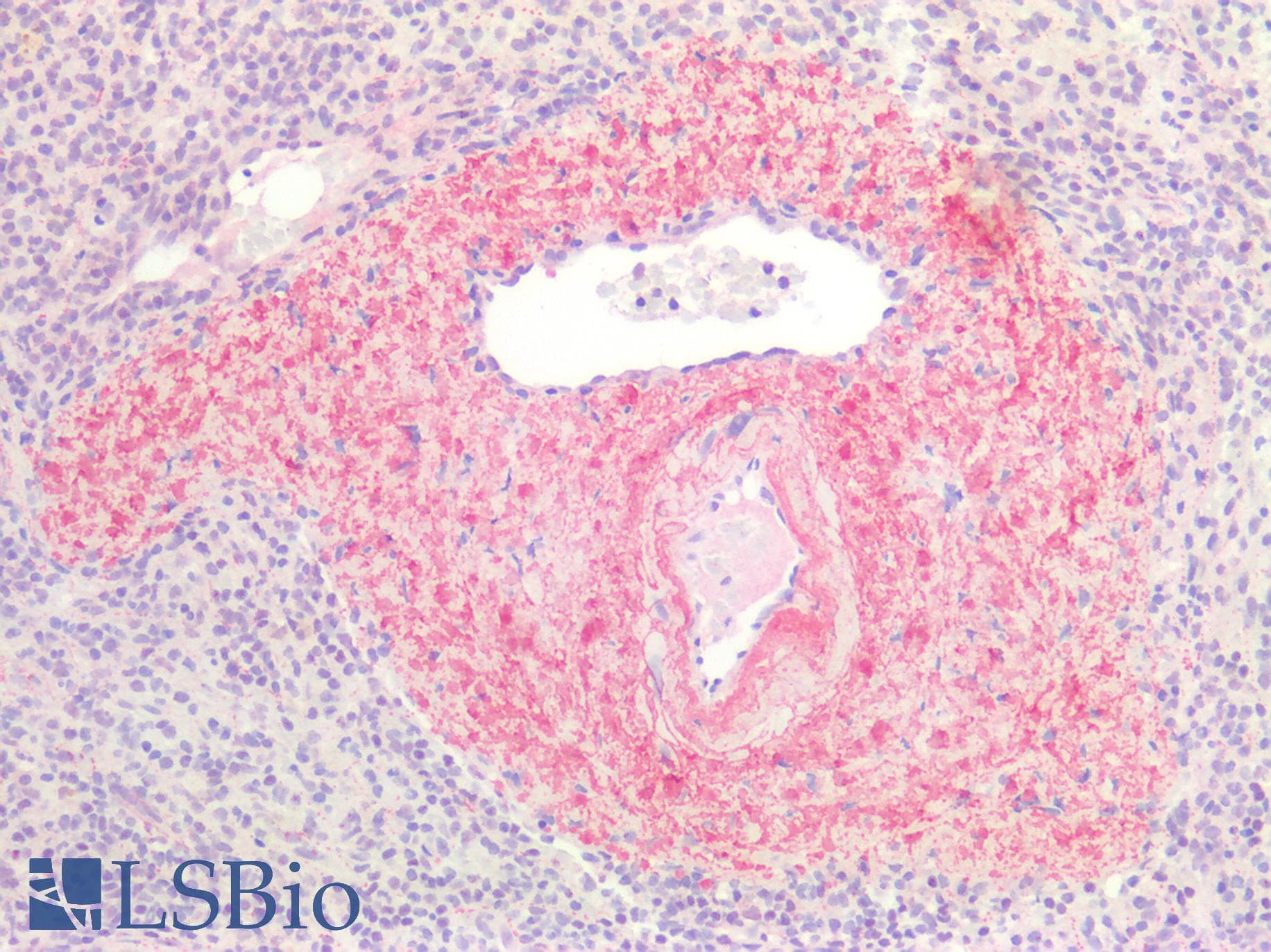 Polyclonal Rabbit anti-Bovine PRSS1 / Trypsin Antibody (Lyophilized, IHC, WB)