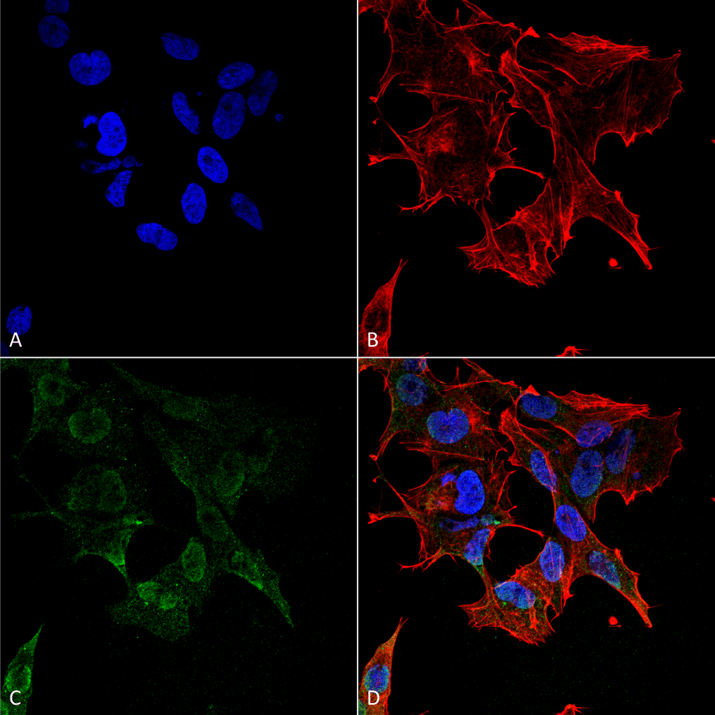 PCDHG / Protocadherin Gamma Antibody (clone S159-5)