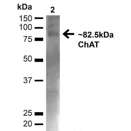 Choline Acetyltransferase Antibody (Biotin)