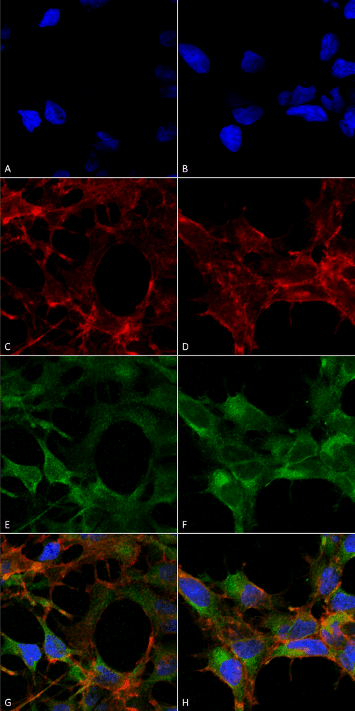 Monoclonal Mouse anti-All species Acrolein Antibody (clone 10A10, APC, IF, WB)