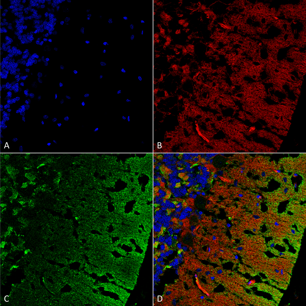 SNCA / Alpha-Synuclein Antibody (clone 3C11)