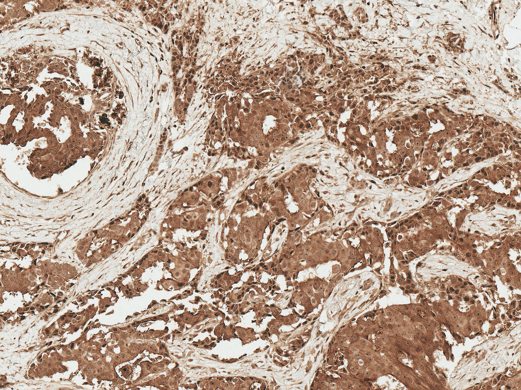 AKT1 Antibody (PerCP)
