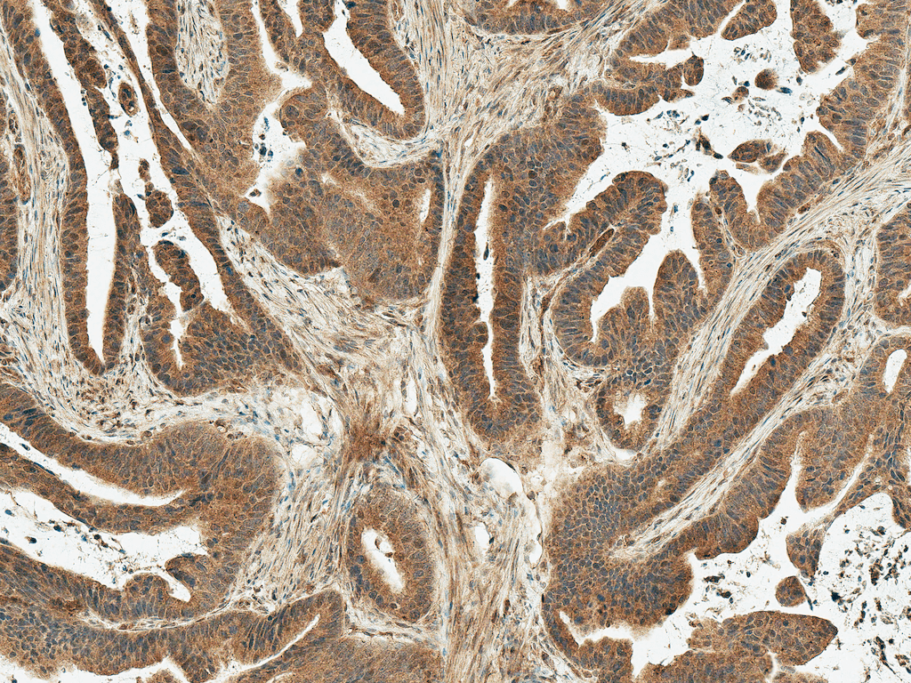 Polyclonal Rabbit anti-Human MDM2 Antibody (IHC, WB)